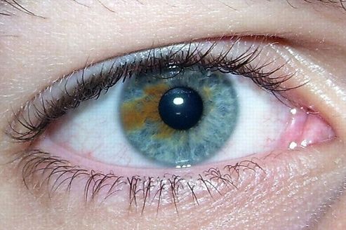 Changer la couleur de ses yeux par laser est dangereux